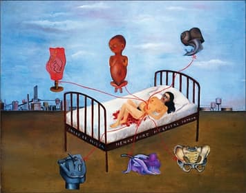 A dark metal hospital bed standing in an empty plain of brown earth under a pale blue sky, with a naked woman lying on a white sheet, her head at the right and blood pooled beneath her hips. Six thin red ribbons gather at her hand and run out to six objects: above the bed a pink anatomical model on a wooden stand, a large foetus and a snail; on the ground below a grey steel machine, a purple orchid and a pale pelvic bone. Factory sheds, a chimney and water towers occupy both horizons, and the bed frame is lettered with the hospital's name